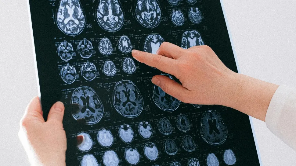 Premieră medicală la Londra